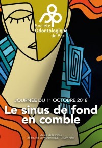 Le sinus de fond en comble